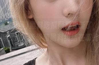 First Image
